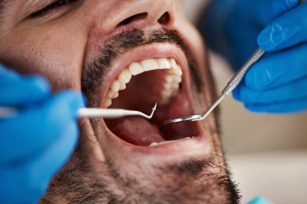 Best Emergency Orthodontic Repairs in Coronita, CA